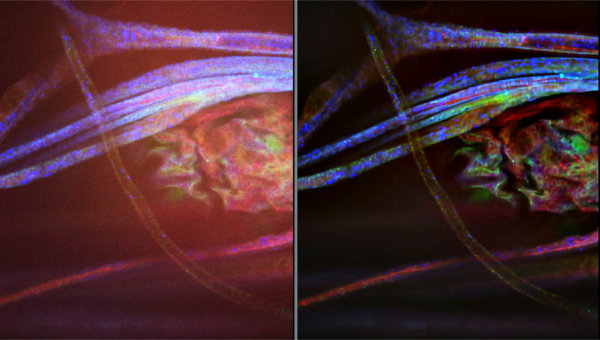 Default image for https://www.zaber.com/articles/automated-microscopy-for-artificial-intelligence