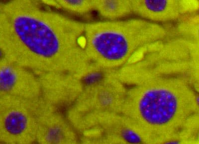 File:Rejuvenation-tech-imaging-2.jpg