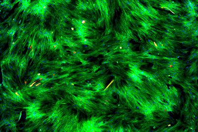 Example image of cultivated cells labeled with fluorescent marker imaged with an MVR microscope