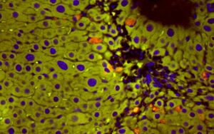 Default image for https://www.zaber.com/articles/rejuvenation-technologies