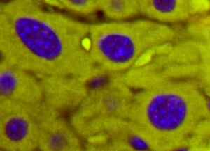 Default image for https://www.zaber.com/articles/rejuvenation-technologies